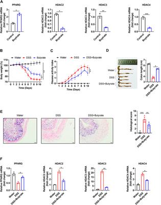 The Synergistic Effects of 5-Aminosalicylic Acid and Vorinostat in the Treatment of Ulcerative Colitis